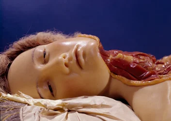 Model of a Man Whose Throat Has Been Cut